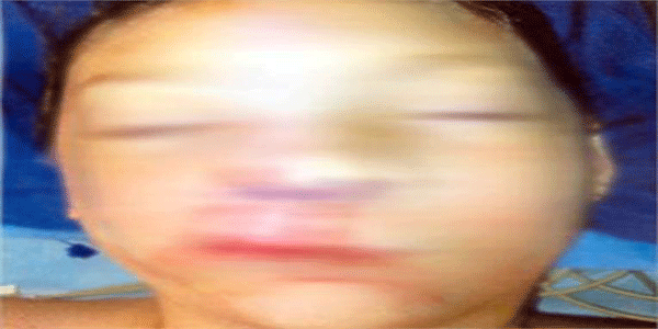 जल्लाद जमींदार, खेत में घुसने पर बच्ची पर छोड़े कुत्ते